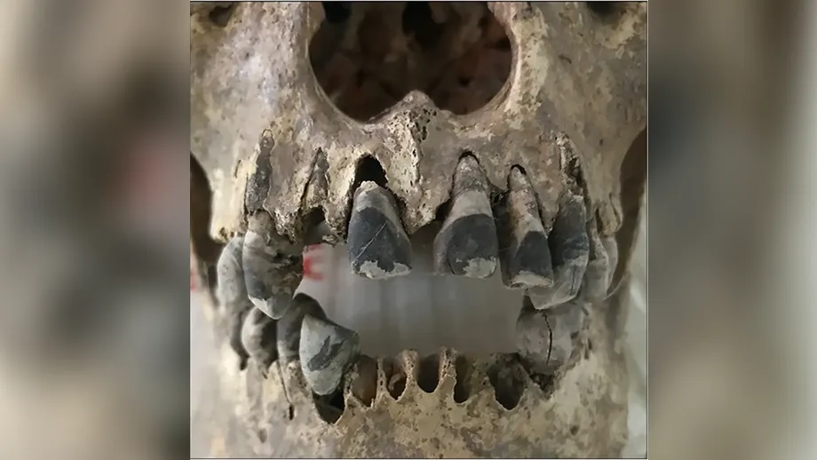 越南古代黑齿：铁器时代社群如何塑造延续2000年的审美标准
